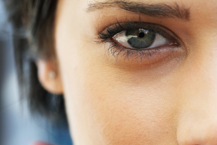 Los problemas de las pestañas pueden producir dolor en el ojo.