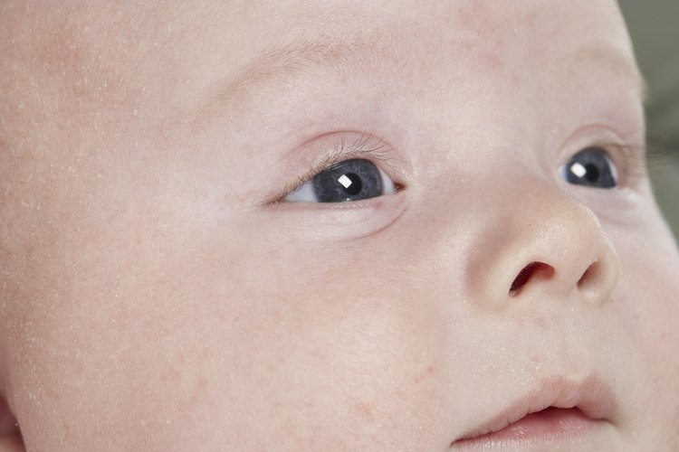 En ocasiones la piel de los bebés luce azulada en climas fríos.