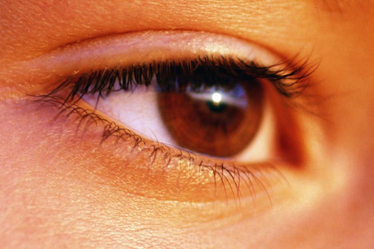 Las protuberancias en el ojo pueden indicar una infección.