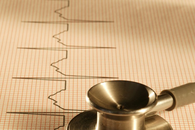 Protege tu corazón evitando alimentos que aumentan los niveles de triglicéridos.