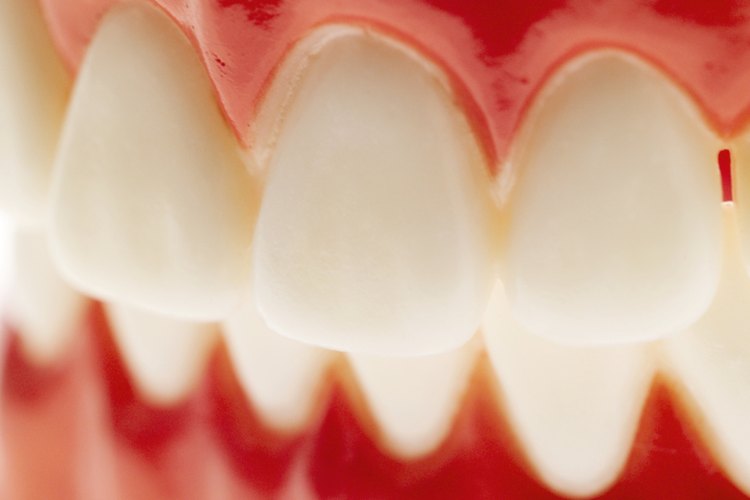 Remover el sarro de tu dentadura ayudará a mantener tus encías y tu boca saludable y fresca.