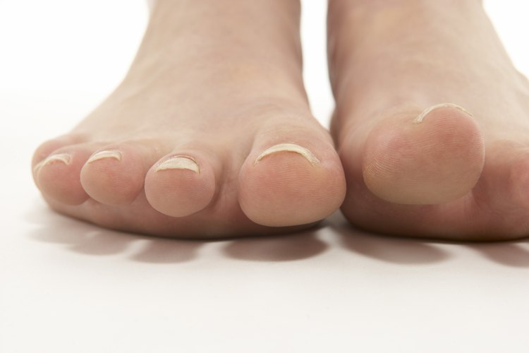 Exfolia y humecta tus pies para prevenir las escamas, las lastimaduras y la piel seca.