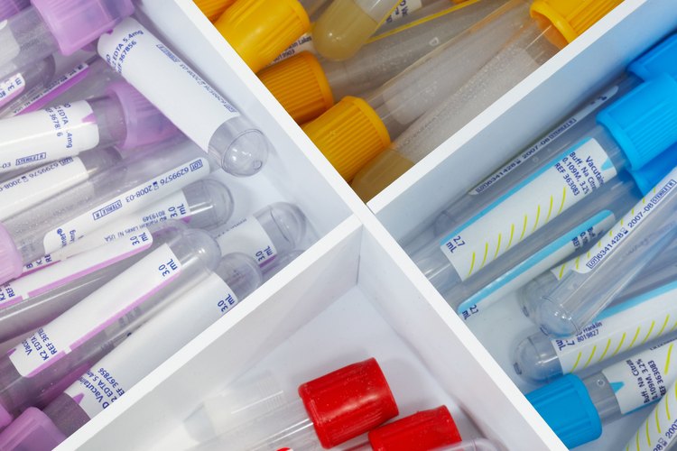 El herpes es es una de las enfermedades de transmisión sexual más comunes.