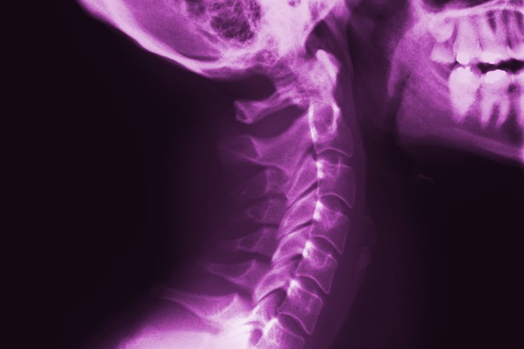 Las radiografías de cervicales son valiosas herramientas de diagnóstico.