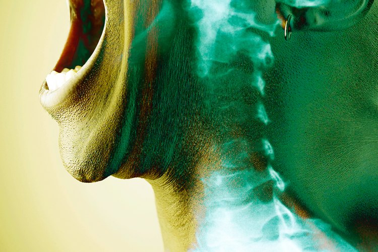 Un esguince en el cuello produce dolor.