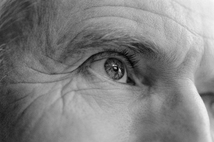 Las arrugas alrededor de los ojos empiezan a aparecer incluso en la juventud.
