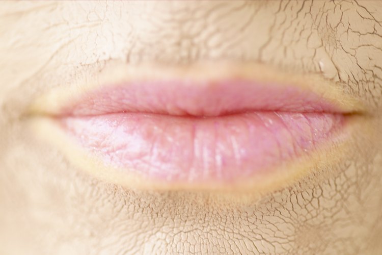 A los labios agrietados les hace falta humedad e hidratación.