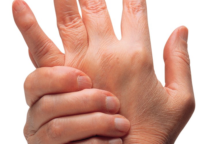 La artritis reumatoide es más común en las mujeres que en los hombres.