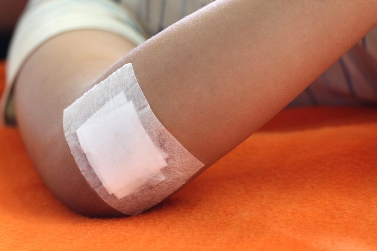 Las heridas infectadas deberían tratarse por facultativo o médico experto.