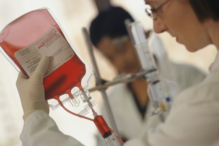 Las condiciones que requieren transfusiones de sangre frecuentes pueden generar un alto contenido de hierro en la sangre.