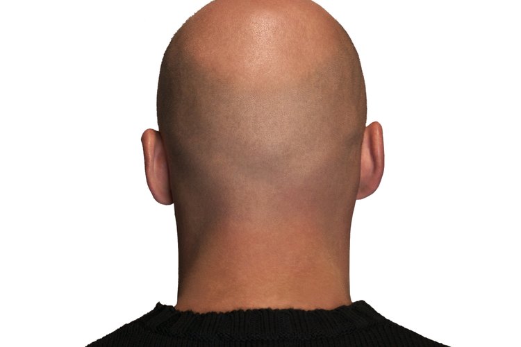 La caída del cabello puede ser un signo de otras patologías.