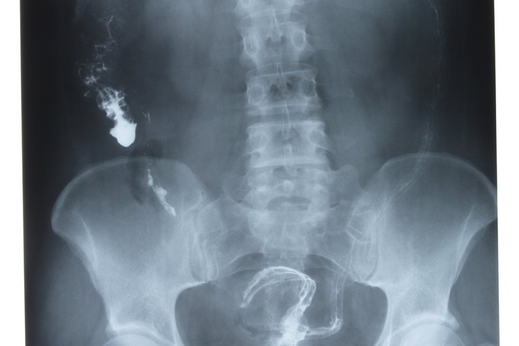 Las radiografías de las caderas y pelvis se utilizan para diagnosticar fracturas por estrés y artritis.