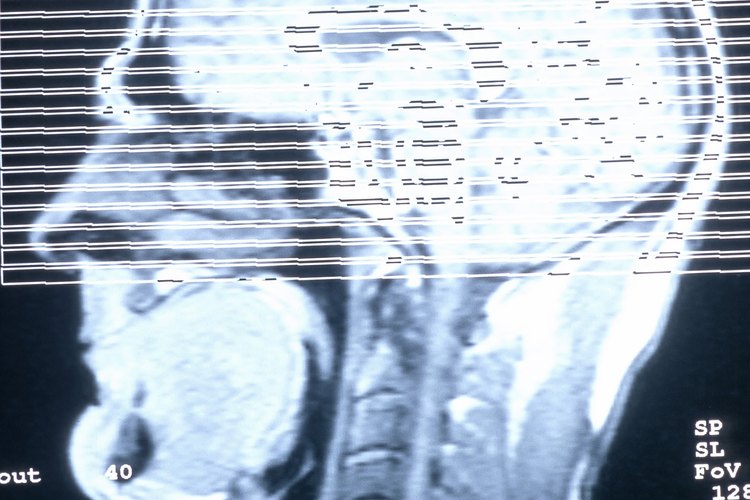 La parte posterior del cerebro es responsable de la visión.