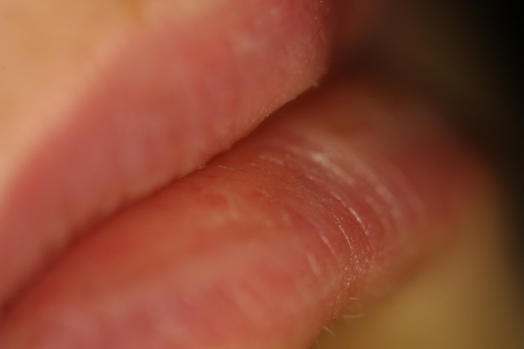 El brillo transparente ayuda a ocultar los labios partidos.