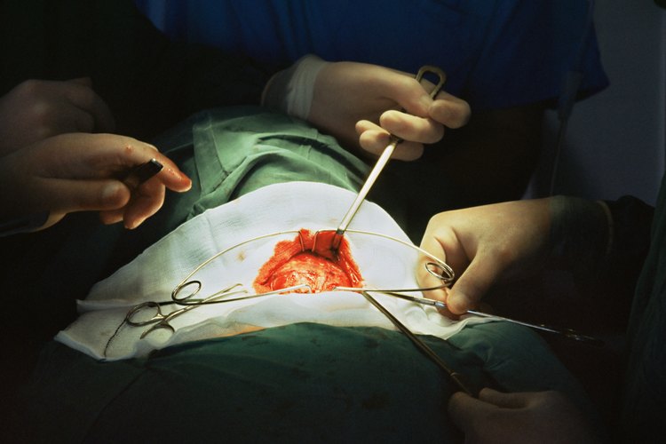 La cirugía es el tratamiento principal para el cáncer de tiroides.