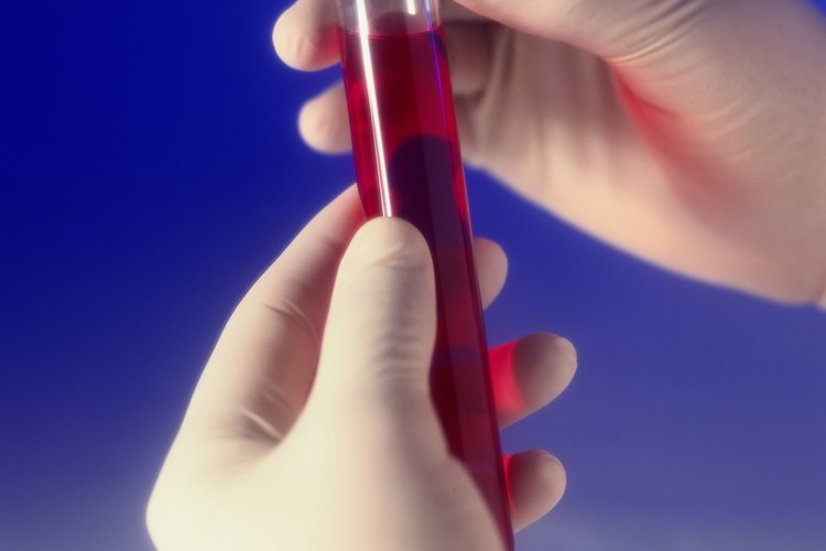 Un sencillo examen de sangre permite conocer los valores de ácido úrico.