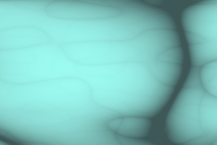 Una arteria tapada puede ser señal de problemas arteriales en otras partes del cuerpo.