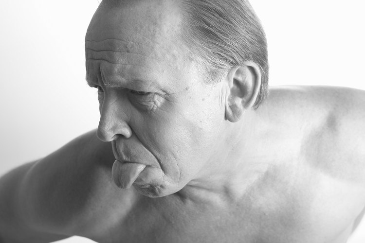 Los granos blancos en la lengua aparecen por varias causas.