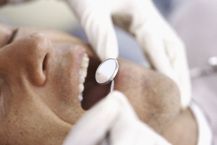 Las alveolitis secas pueden ocurrir luego de la extracción de un diente.