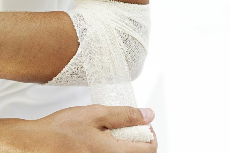 La tendinitis se considera crónica cuando es recurrente y no logra mejorar.