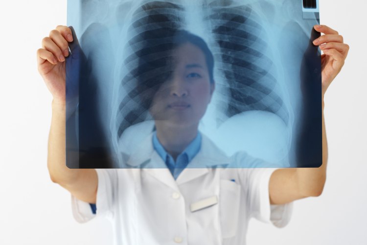 La tuberculosis suele afectar los pulmones.