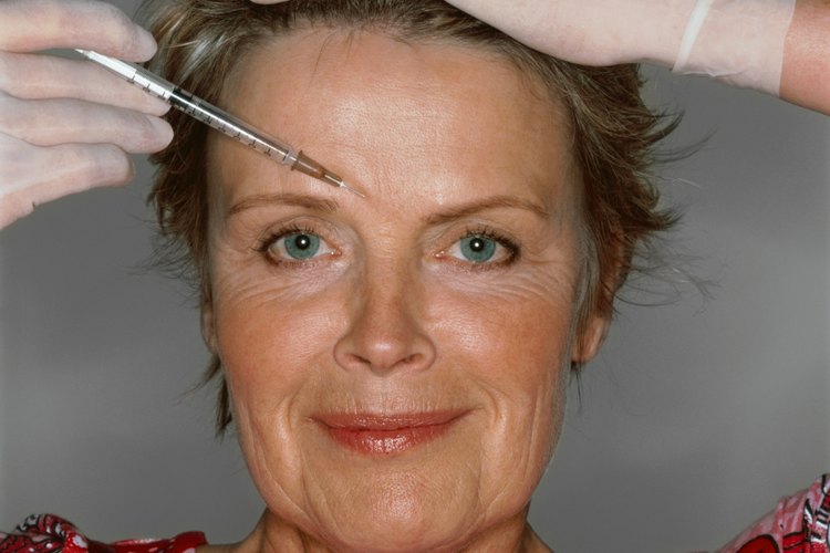 El 1% de los pacientes que se aplican Botox sufre de ptosis en la ceja.