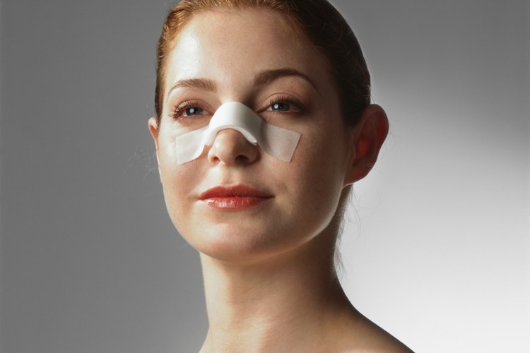 Prepararse para una rinoplastia.