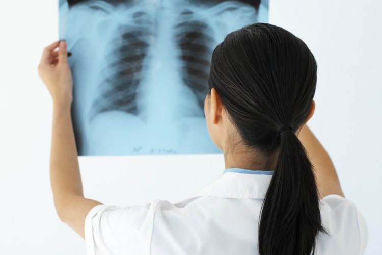 Pulmones.
