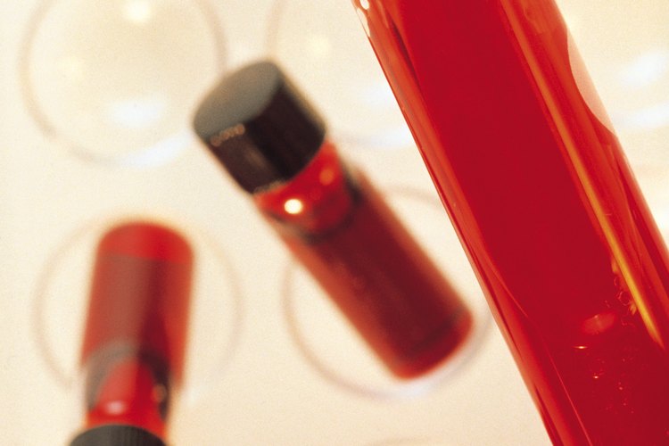 Hoy en día, los análisis de sangre sirven para diagnosticar muchas enfermedades.