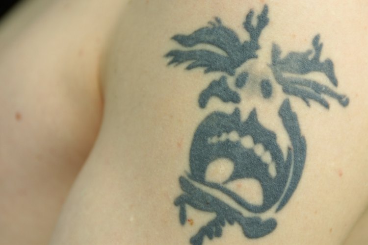 Un tatuaje puede implicar complicaciones.