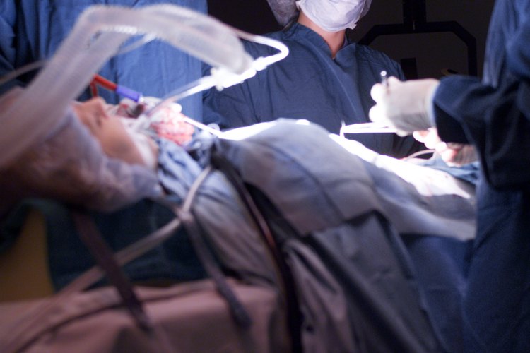 Una histerectomía parcial o histerectomía abdominal, es un procedimiento quirúrgico común que implica la remoción del útero a través de un incisión en el abdomen bajo.
