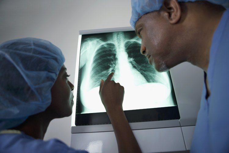 La estructura de los pulmones.