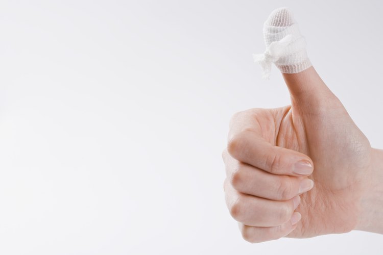 Dependiendo de la severidad de tu problema, la técnica de rehabilitación de tu pulgar en gatillo puede variar.