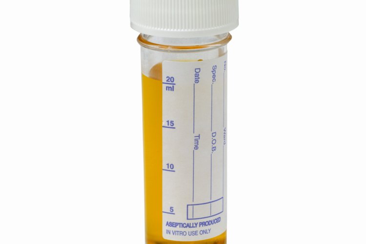 Un análisis de orina es una prueba que se lleva a cabo en el consultorio de tu médico donde se explican varios aspectos de tu salud.