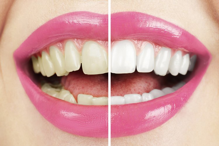 Consigue una sonrisa más blanca de manera natural.