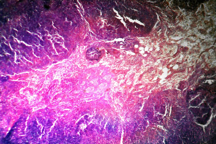 En los ganglios linfáticos las células combaten las infecciones y expulsan las sustancias dañinas de tu cuerpo.