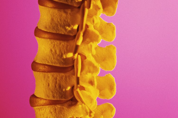 A muchos pacientes con escoliosis se les indica usar corsé, pero el vendaje neuromuscular está siendo usado para los casos leves para dar soporte a la columna.