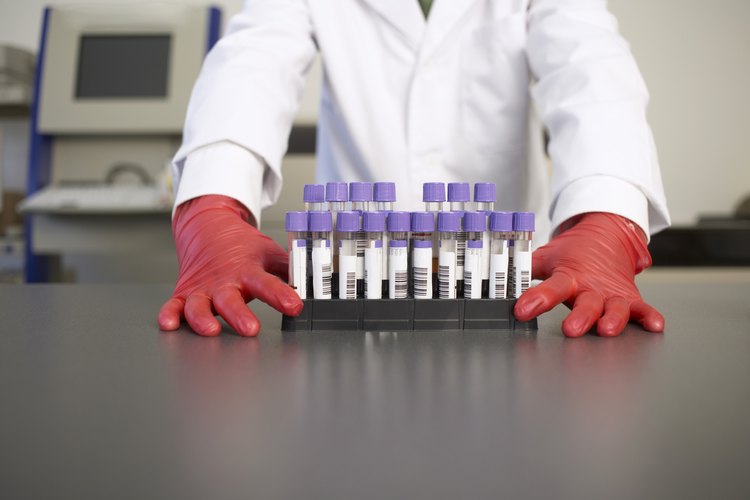 La concentración de hemoglobina está dada por el número de células rojas en relación con la edad y el sexo del individuo.