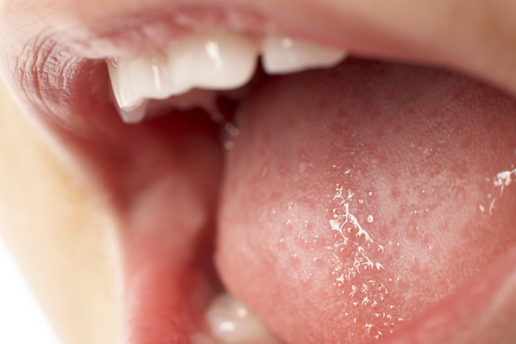 Los bultos dentro de tu boca pueden ser úlceras bucales, quistes mucosos, liquen plano oral o papilas inflamadas.