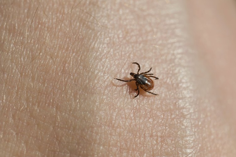 No todas las garrapatas y no todas las picaduras de garrapatas transmiten la enfermedad de Lyme.