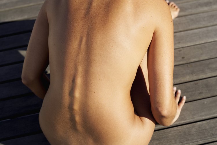 La cirugía de reemplazo de disco cervical se realiza cuando uno o más discos degenerados situados en la columna vertebral entre las vértebras necesitan ser reemplazados.