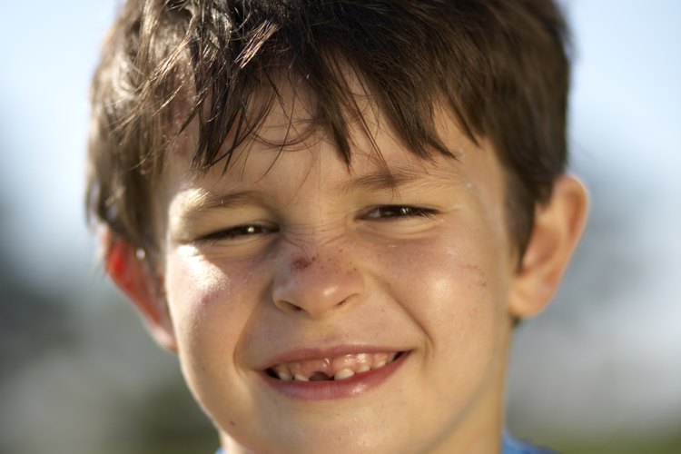Los niños son desproporcionadamente afectados por el autismo.