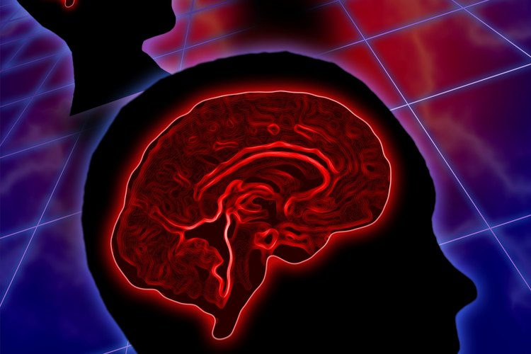 Un cerebro.
