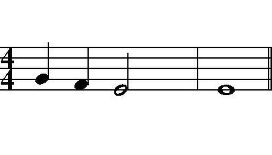 A series of notes