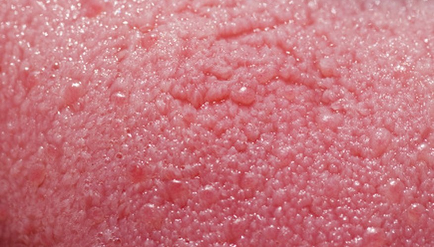 Types Of Bacteria On The Tongue Sciencing