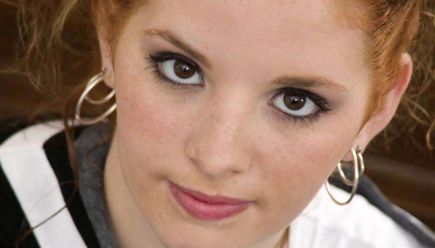 A flaky scalp is common among teenagers. A flaky scalp is common among teenagers.