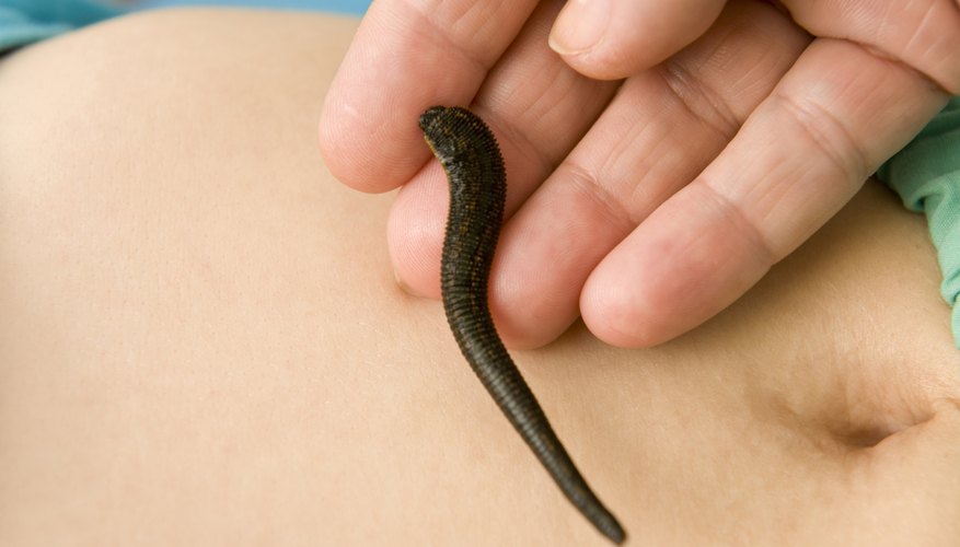 Man holding a leech Man holding a leech
