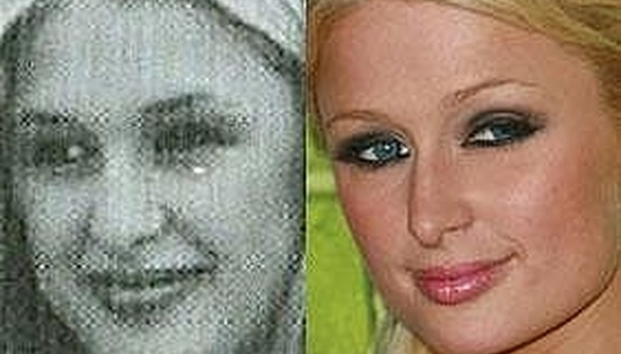 Paris Hilton's Nose Job