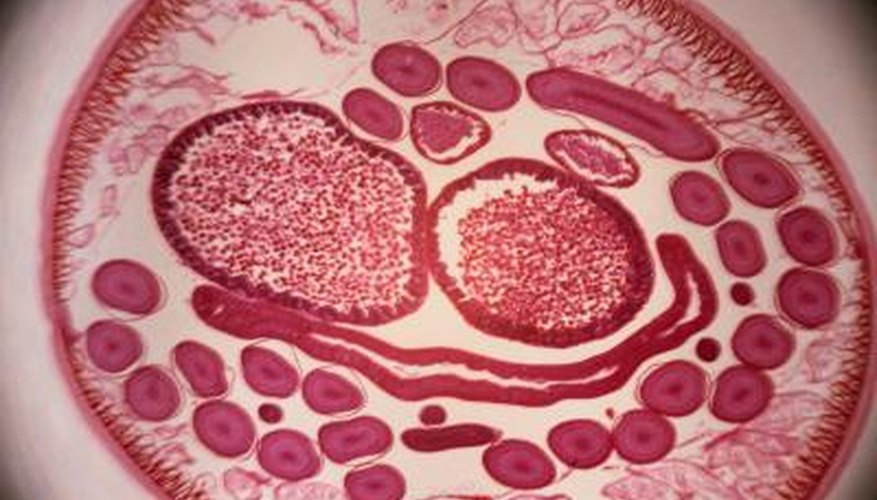 Microscopic worms can do unseen harm to hollies ultimately killing them. Microscopic worms can do unseen harm to hollies ultimately killing them.
