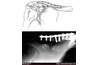 Clavicle plate and screws